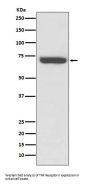Anti-TNF Receptor II TNFRSF1B Rabbit Monoclonal Antibody