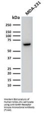 Anti-GnRH-Receptor / LH-RH Receptor Monoclonal Antibody