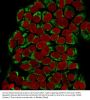 Anti-GnRH-Receptor / LH-RH Receptor Monoclonal Antibody