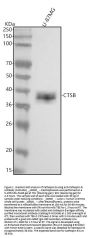 Anti-Cathepsin B CTSB Rabbit Monoclonal Antibody
