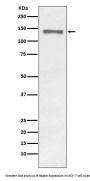 Anti-Raptor RPTOR Rabbit Monoclonal Antibody