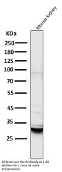 Anti-BNIP3 Rabbit Monoclonal Antibody