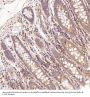 Anti-BNIP3 Rabbit Monoclonal Antibody
