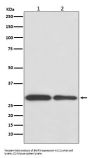 Anti-BNIP3 Rabbit Monoclonal Antibody