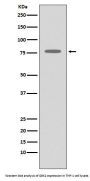 Anti-GRK2 ADRBK1 Rabbit Monoclonal Antibody