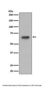Anti-S6K1 RPS6KB1 Rabbit Monoclonal Antibody