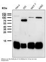 Anti-Profilin1 PFN1 Rabbit Monoclonal Antibody