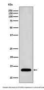 Anti-Profilin1 PFN1 Rabbit Monoclonal Antibody