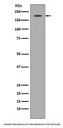 Anti-Met (c-Met) Rabbit Monoclonal Antibody