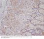 Anti-Met (c-Met) Rabbit Monoclonal Antibody