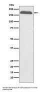 Anti-A2M/Alpha 2 Macroglobulin Rabbit Monoclonal Antibody