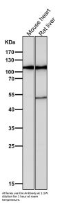 Anti-Hexokinase 1 HK1 Rabbit Monoclonal Antibody