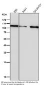 Anti-Hexokinase 1 HK1 Rabbit Monoclonal Antibody