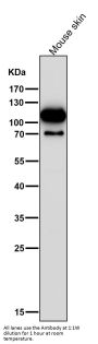 Anti-Hexokinase 1 HK1 Rabbit Monoclonal Antibody