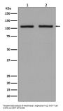 Anti-Hexokinase 1 HK1 Rabbit Monoclonal Antibody