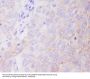 Anti-Hexokinase 1 HK1 Rabbit Monoclonal Antibody