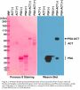 Anti-PSA (Prostate Specific Antigen) Rabbit Monoclonal Antibody, Clone#RM323