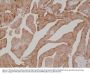 Anti-PSA (Prostate Specific Antigen) Rabbit Monoclonal Antibody, Clone#RM323