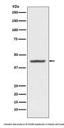 Anti-HMBS Rabbit Monoclonal Antibody
