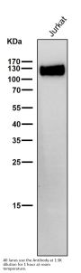 Anti-CD31 PECAM1 Rabbit Monoclonal Antibody