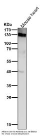 Anti-CD31 PECAM1 Rabbit Monoclonal Antibody