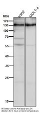 Anti-CD31 PECAM1 Rabbit Monoclonal Antibody