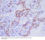 Anti-CD31 PECAM1 Rabbit Monoclonal Antibody