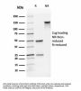 Anti-CD31 / PECAM-1 (Endothelial Cell Marker) Monoclonal Antibody
