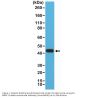 Anti-Matrix metalloproteinase-12 (MMP-12) Rabbit Monoclonal Antibody, Clone#RM381