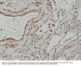 Anti-Matrix metalloproteinase-12 (MMP-12) Rabbit Monoclonal Antibody, Clone#RM381