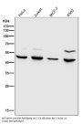 Anti-MMP12 Rabbit Monoclonal Antibody