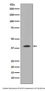 Anti-MMP12 Rabbit Monoclonal Antibody