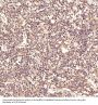 Anti-LC3B MAP1LC3B Rabbit Monoclonal Antibody