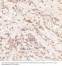 Anti-LC3B MAP1LC3B Rabbit Monoclonal Antibody