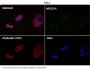 Anti-LC3B MAP1LC3B Rabbit Monoclonal Antibody