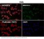 Anti-MAP1LC3A/Lc3A Rabbit Monoclonal Antibody