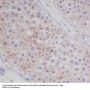 Anti-MAP1LC3A/Lc3A Rabbit Monoclonal Antibody