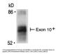 Anti-BIN1 Monoclonal Antibody