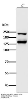 Anti-Integrin alpha V ITGAV Rabbit Monoclonal Antibody