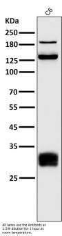 Anti-Integrin alpha V ITGAV Rabbit Monoclonal Antibody