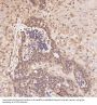 Anti-Integrin alpha V ITGAV Rabbit Monoclonal Antibody