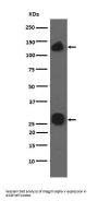 Anti-Integrin alpha V ITGAV Rabbit Monoclonal Antibody