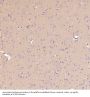 Anti-Integrin alpha V ITGAV Rabbit Monoclonal Antibody