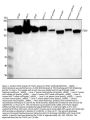 Anti-Integrin alpha V ITGAV Rabbit Monoclonal Antibody
