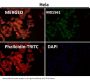Anti-Integrin alpha V ITGAV Rabbit Monoclonal Antibody