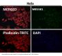 Anti-Integrin alpha V ITGAV Rabbit Monoclonal Antibody