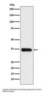 Anti-HSD11B1 Rabbit Monoclonal Antibody