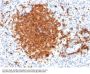 Anti-CD22 / BL-CAM Monoclonal Antibody