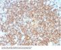 Anti-CD22 / BL-CAM Monoclonal Antibody