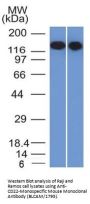 Anti-CD22 / BL-CAM Monoclonal Antibody